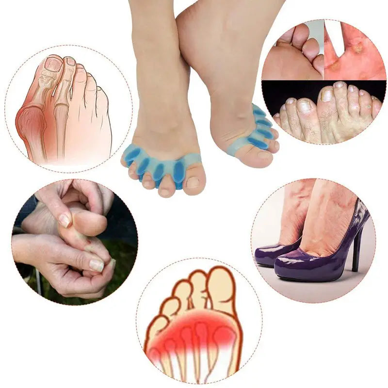 Toe Separators Bunions Correctors and Restoring Toys for Relaxing Toes, Bunion Relief, Hammer Toe